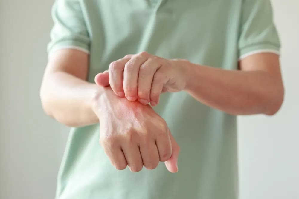 Svetski dan borbe protiv psorijaze: U Srbiji 140.000 obolelih