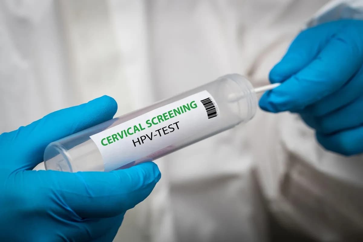 HPV otkriven kod svake osme testirane žene u Srbiji