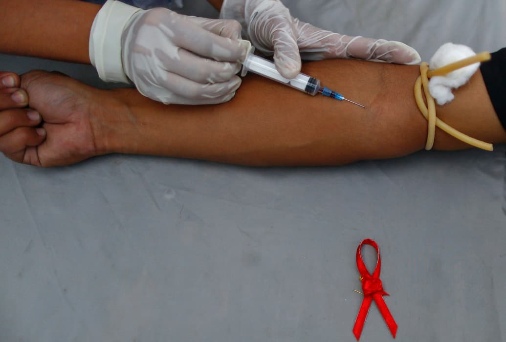 Prokić: Strah i stigma i dalje udaljavaju ljude od HIV testiranja u Srbiji