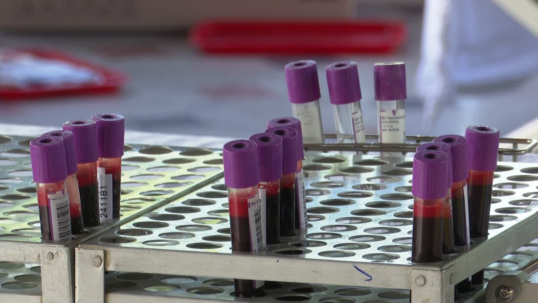 Razvijena nova metoda za dijagnostikovanje bolesti materice pomoću analiza krvi