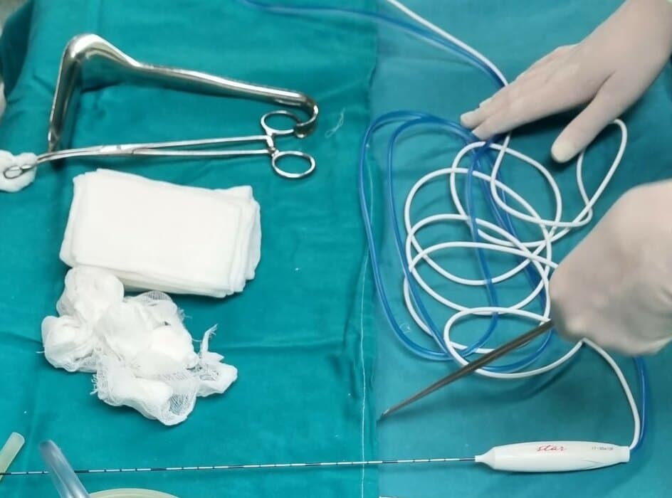 Na Dedinju prvi put u Srbiji endoskopski zamenjene dve srčane valvule u jednom aktu