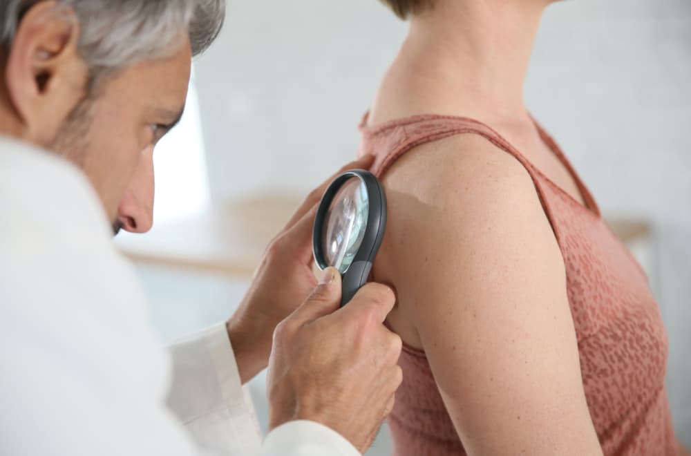 Da li treba preventivno uklanjati mladeže? Dermatolog otkriva pet znakova koji mogu da ukazuju na rak kože