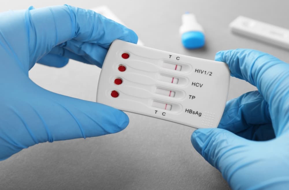 Veliki korak u borbi protiv HIV-a: Novi materijal ruskih naučnika smanjio virus 100.000 puta