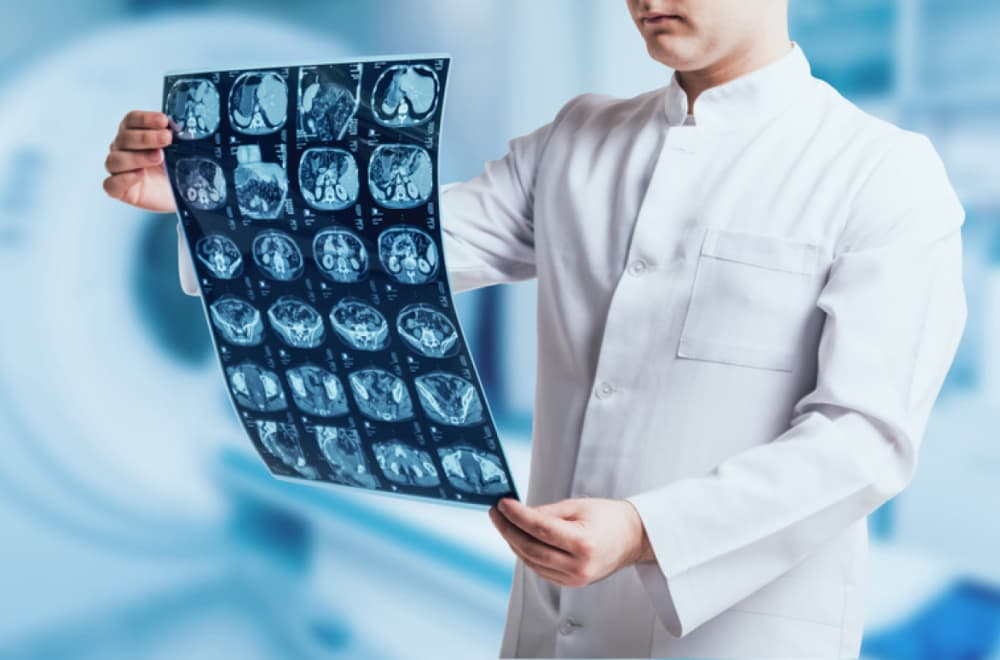 Nova nada za lečenje glioblastoma: Otkriven "prekidač" koji pokreće najopasniji tumor mozga