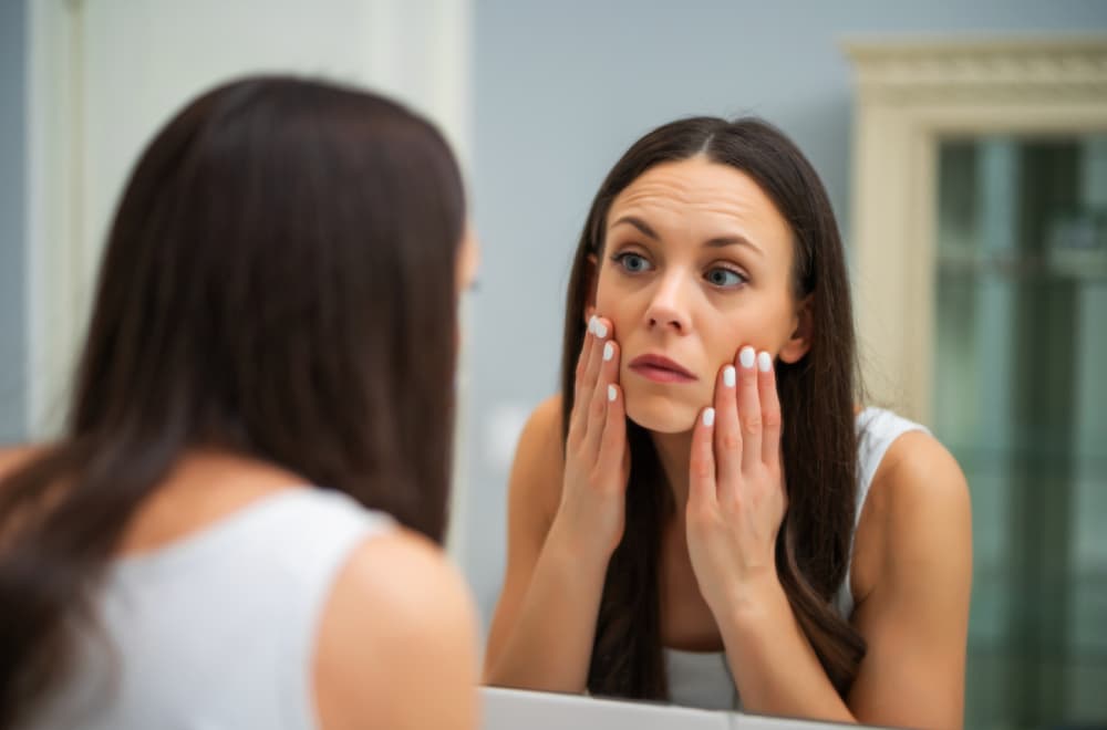 Gnojne akne nisu samo estetski problem: Hormonske promene mogu da budu okidači