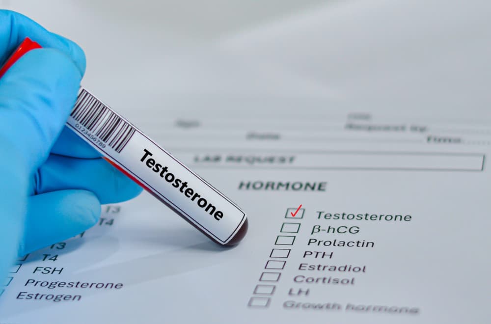 Nivo testosterona kod muškaraca se prepolovio: Najniži u poslednjih pet decenija